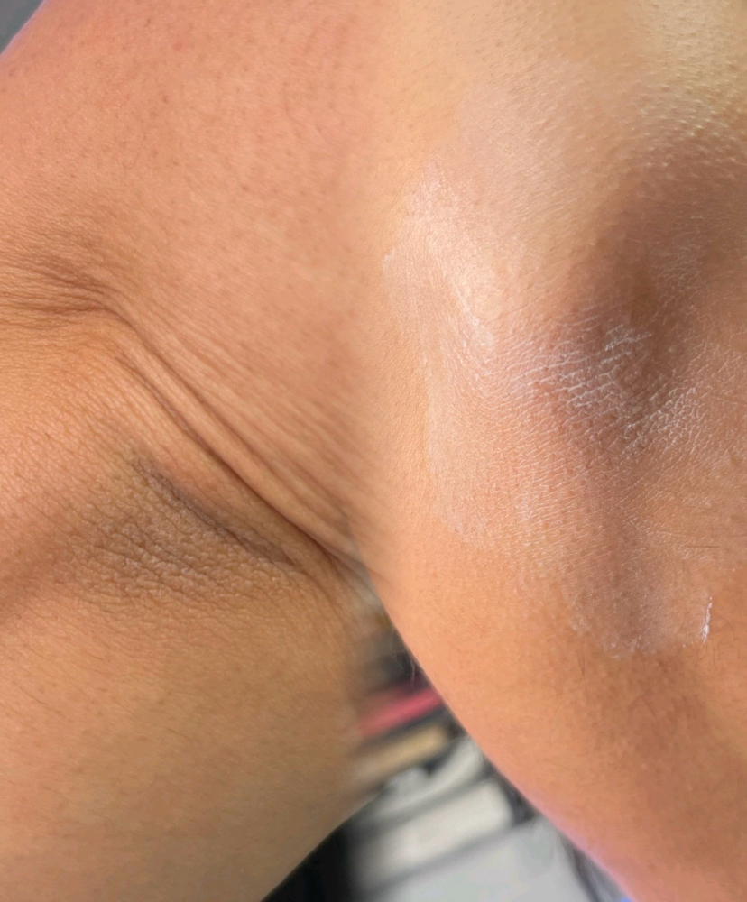 Spotlight Glow Treatment at Adarable Esthetics LLC in Taunton, MA