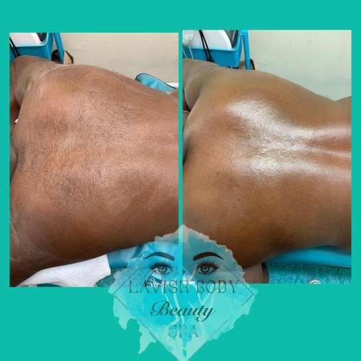 Male Full Back Waxing