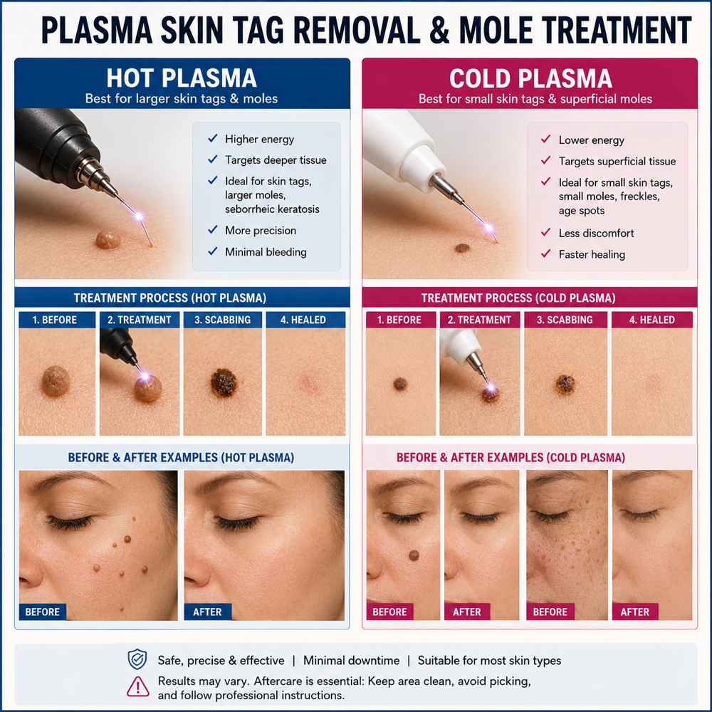 Hot And Cold Plasma Treatment at Lux Skincare Therapy & VVS Smile Bar in Palm Desert, CA