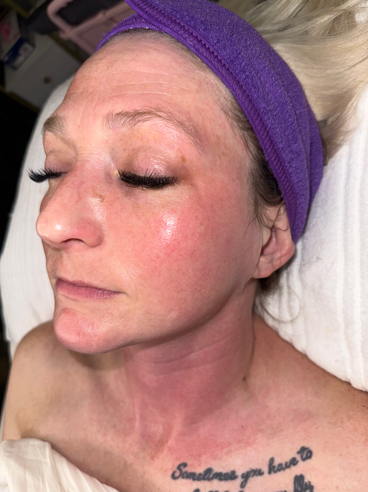 Firming Peptide Mask