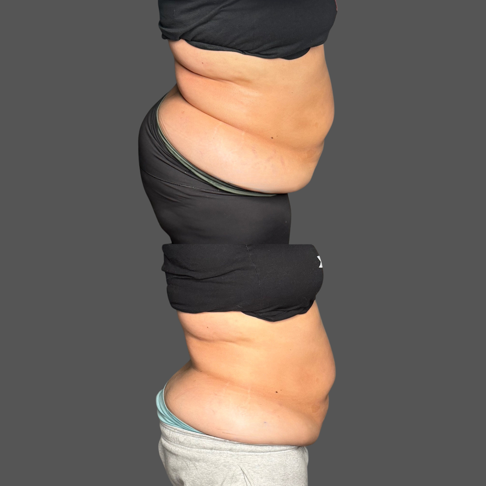 Body Sculpting ***Per Session*** at Lashes By Emily98 in Kyle, TX