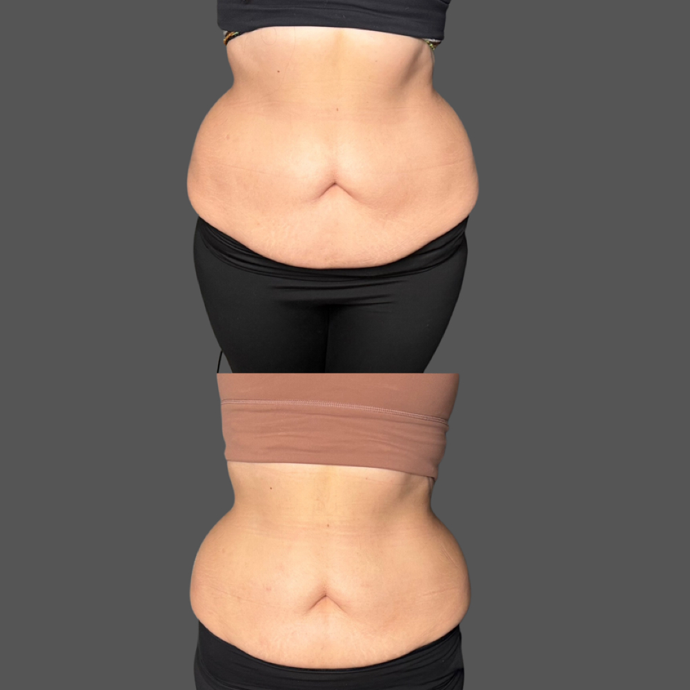 Body Sculpting ***Per Session*** at Lashes By Emily98 in Kyle, TX