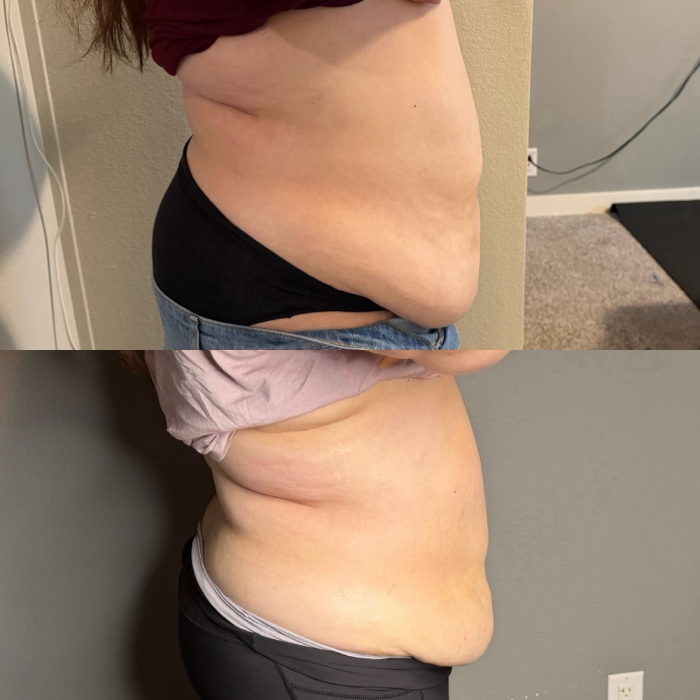 Body Sculpting ***Per Session*** at Lashes By Emily98 in Kyle, TX