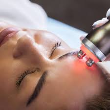 Radio Frequency Facial