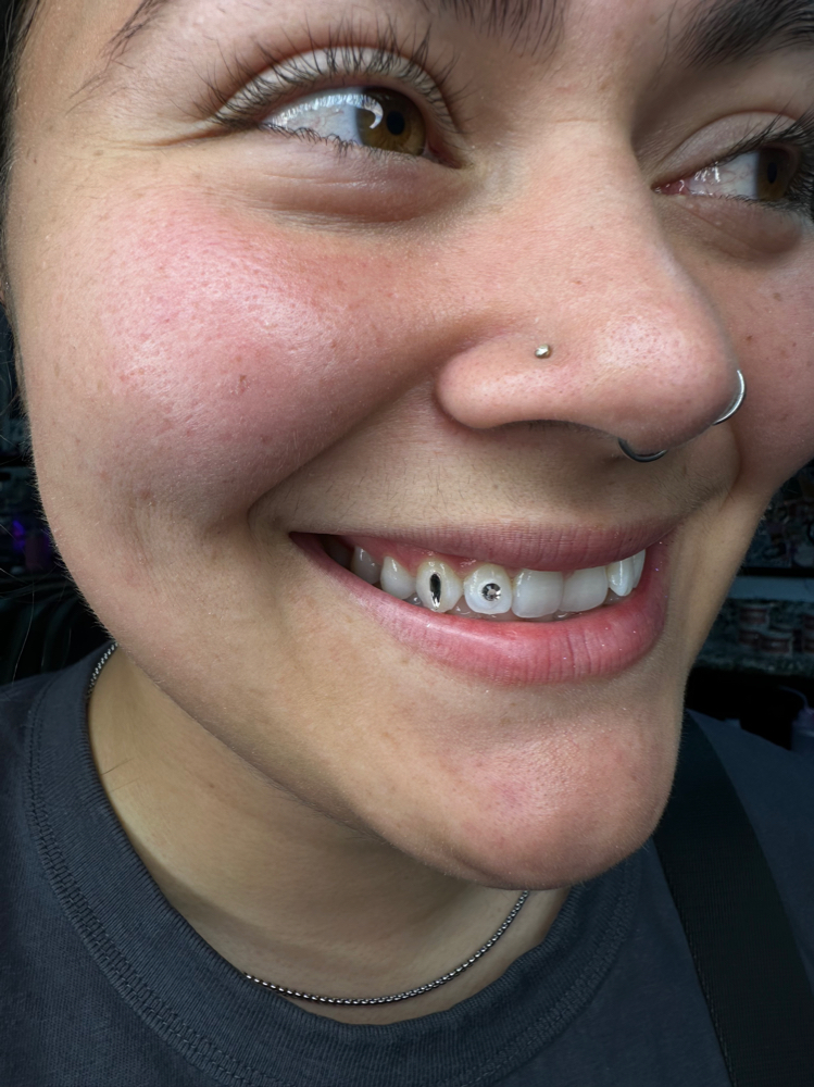 Two Tooth Gems