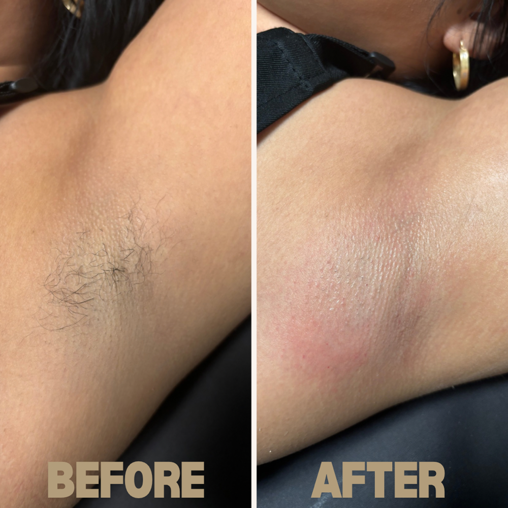 Underarm Wax
