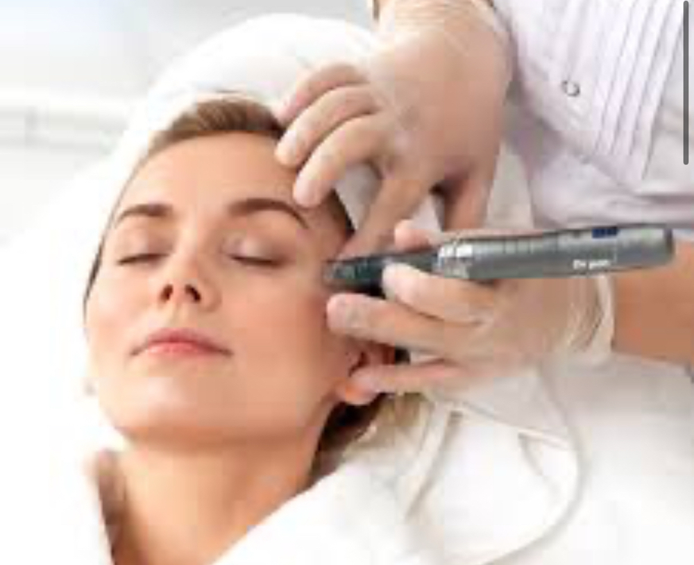 Microneedling Face And Neck