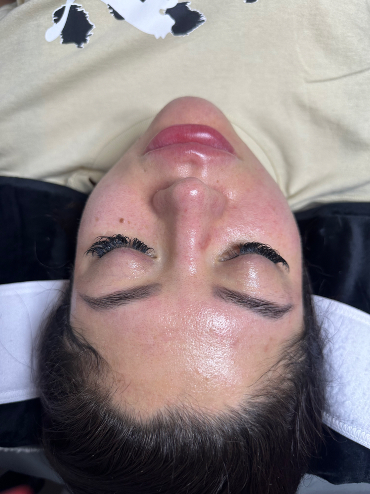 Diamond Microdermabrasion at Bellissima Skin & Beauty in Madison, WI