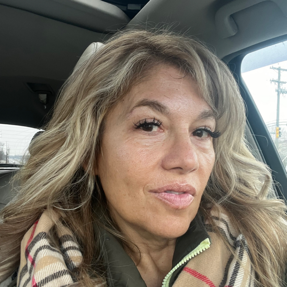 Partial Foils at Hair Restoration By Melz in Hamilton, NJ