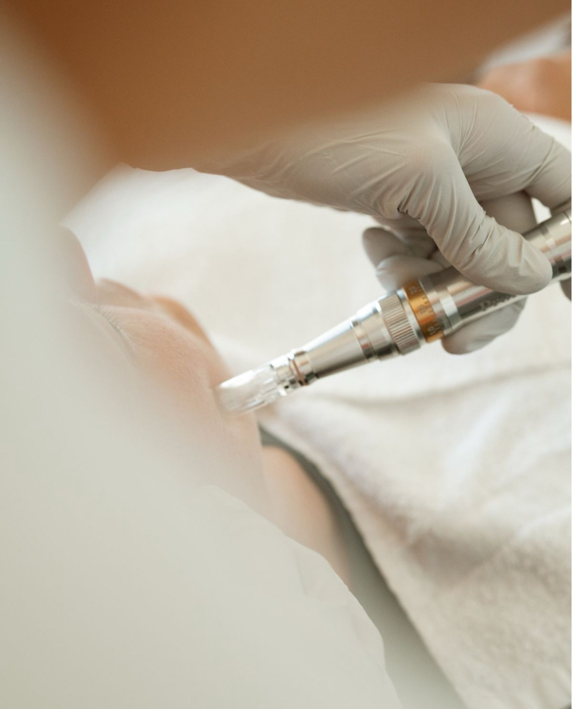 Microneedling Face+Neck