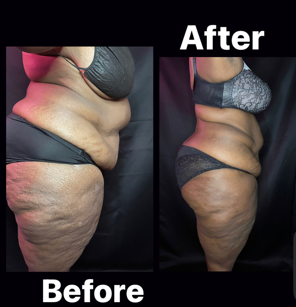 WaistLine Snatched 360 (6 Sessions) at Royal Glow Experience LLC in Houston, TX