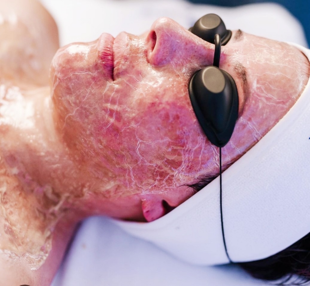 Beyond Botox Facial