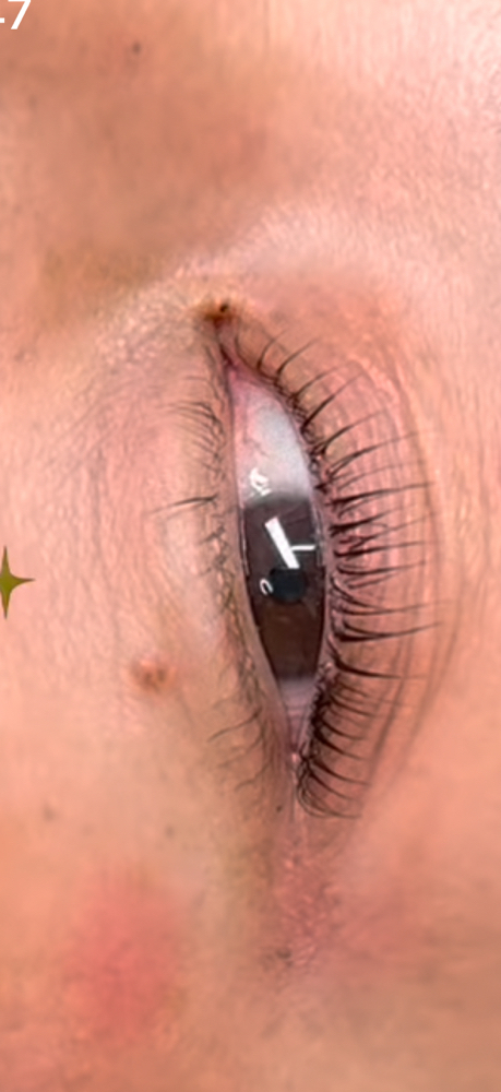 Liftlash