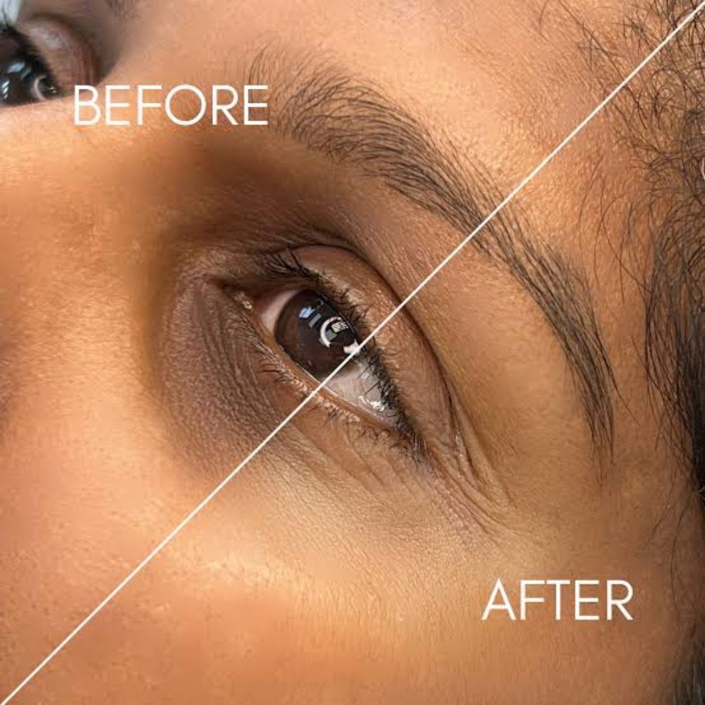 Under-Eye Brightening at SR Beauty Studios in Sacramento, CA