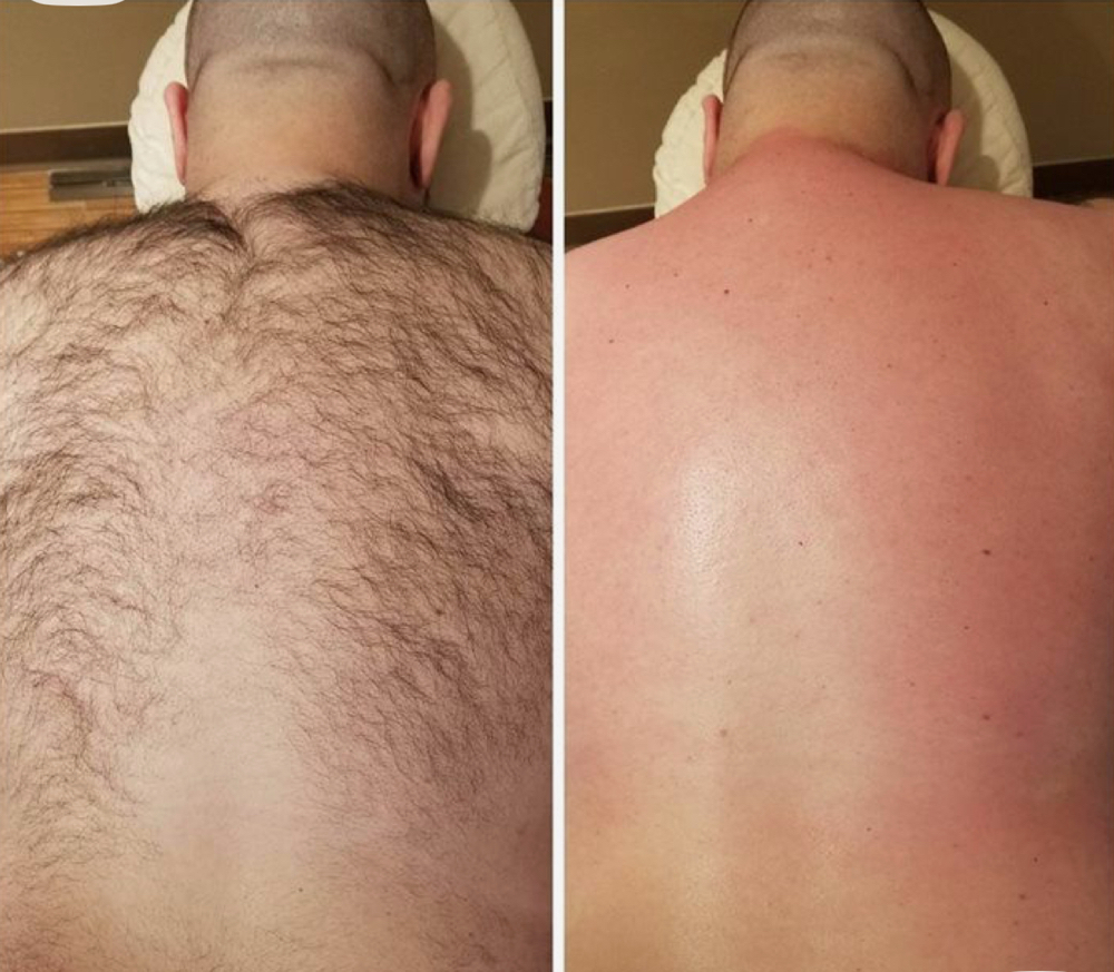 Mens Back Wax