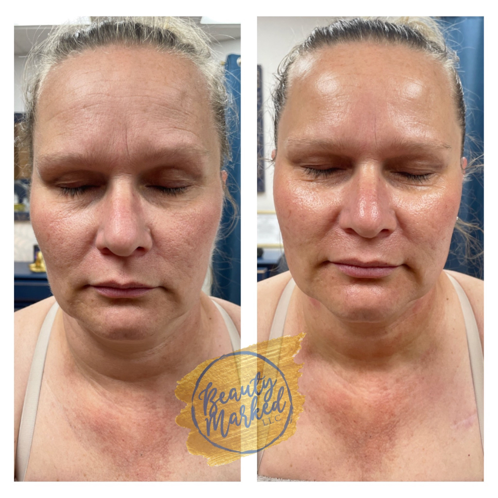 Beauty Marked Lift And Firm Facial