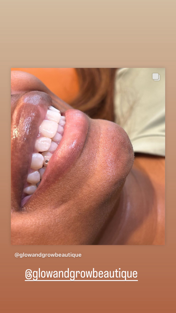 Tooth Gems