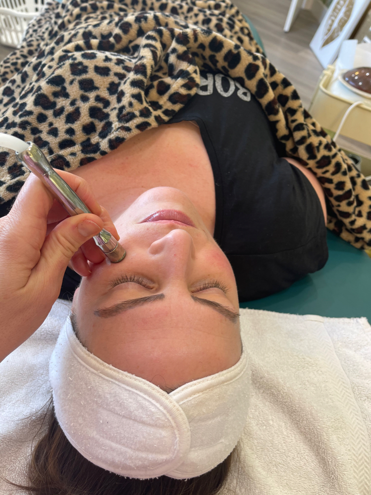 Microdermabrasion