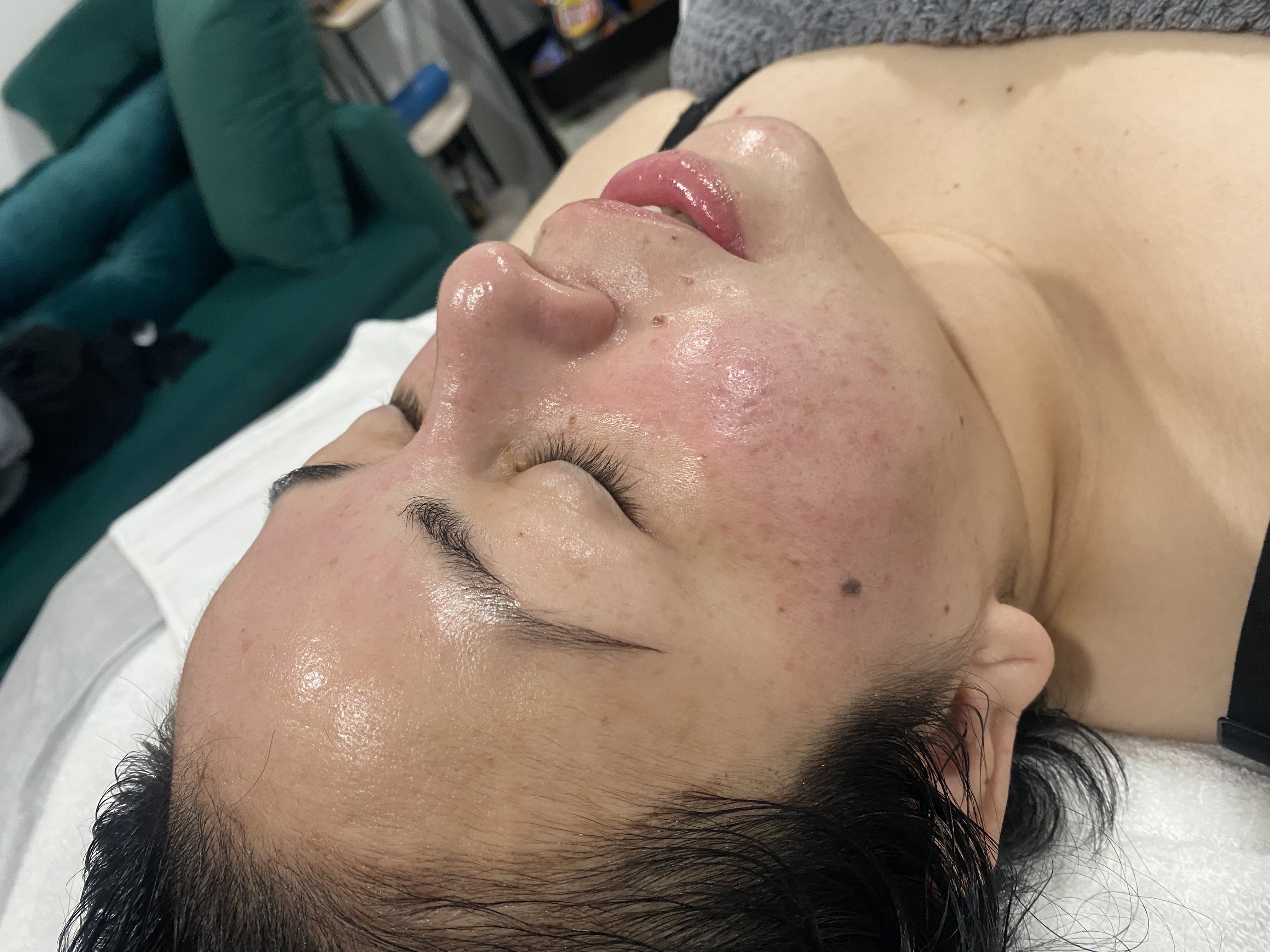 Custom facial