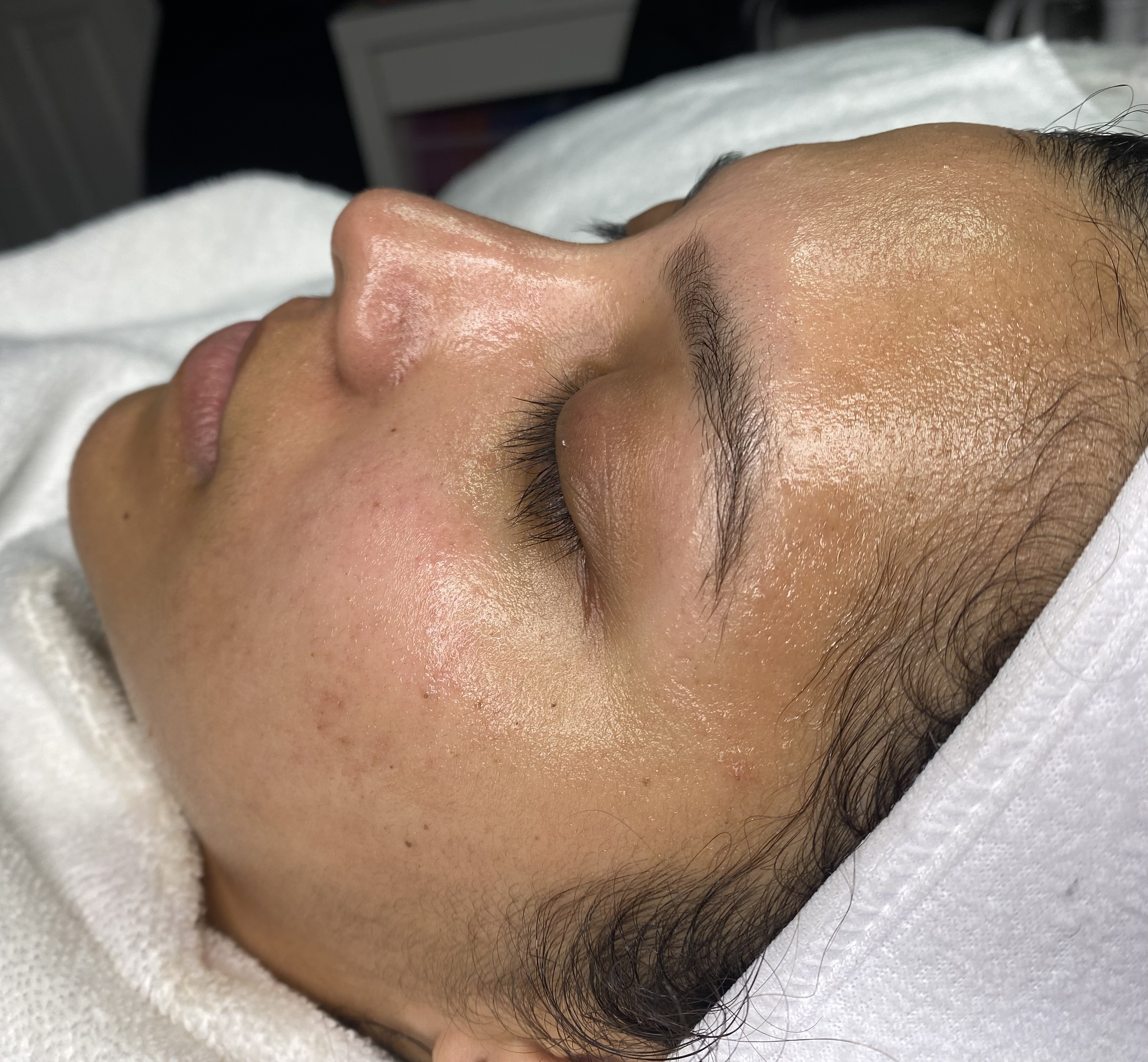 Custom facial