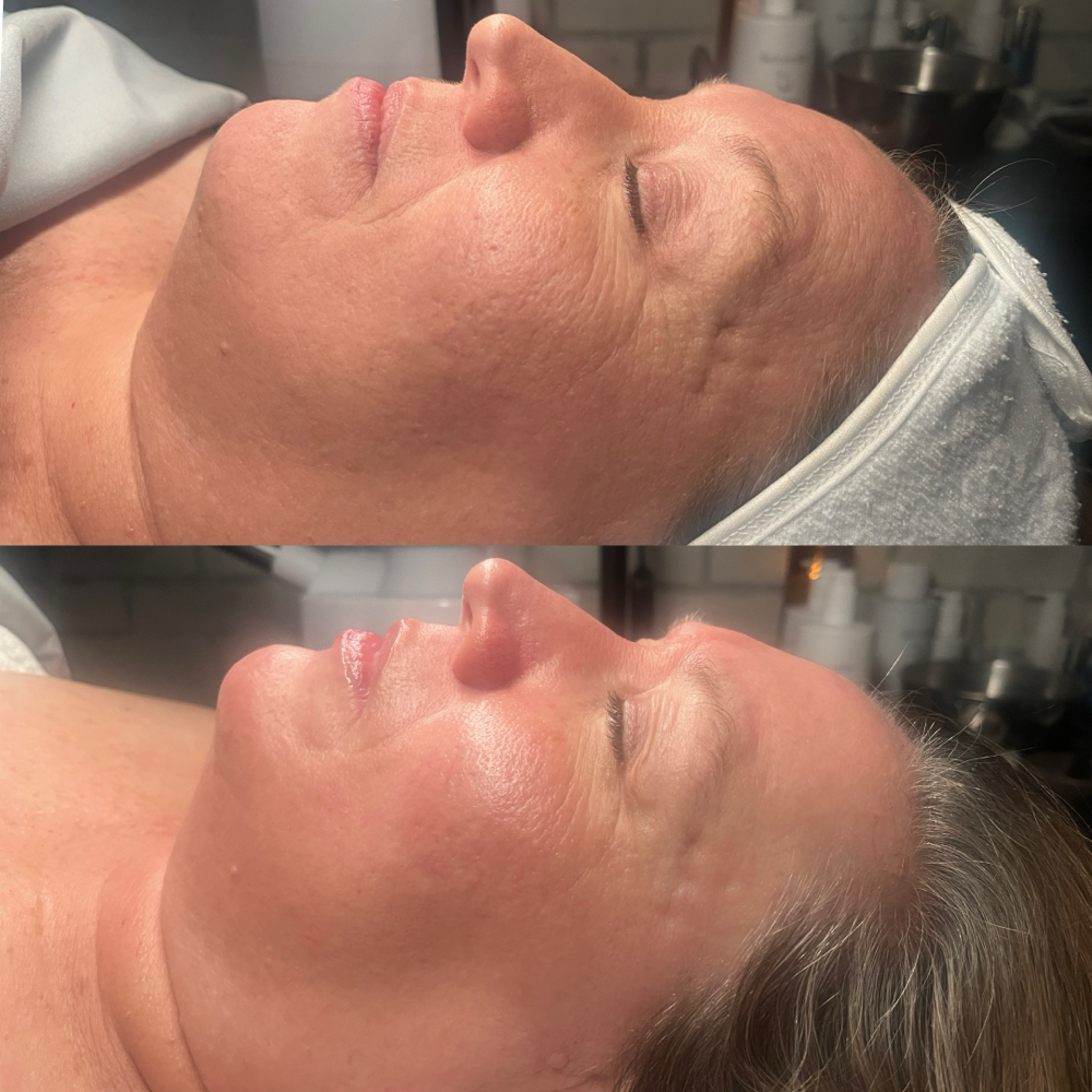 The Firming Facial