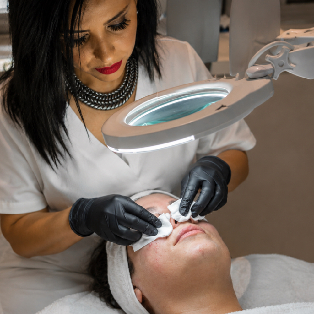Acne treatment / Extra extractions at Kal's Esthetician Clinic in Colorado Springs, CO