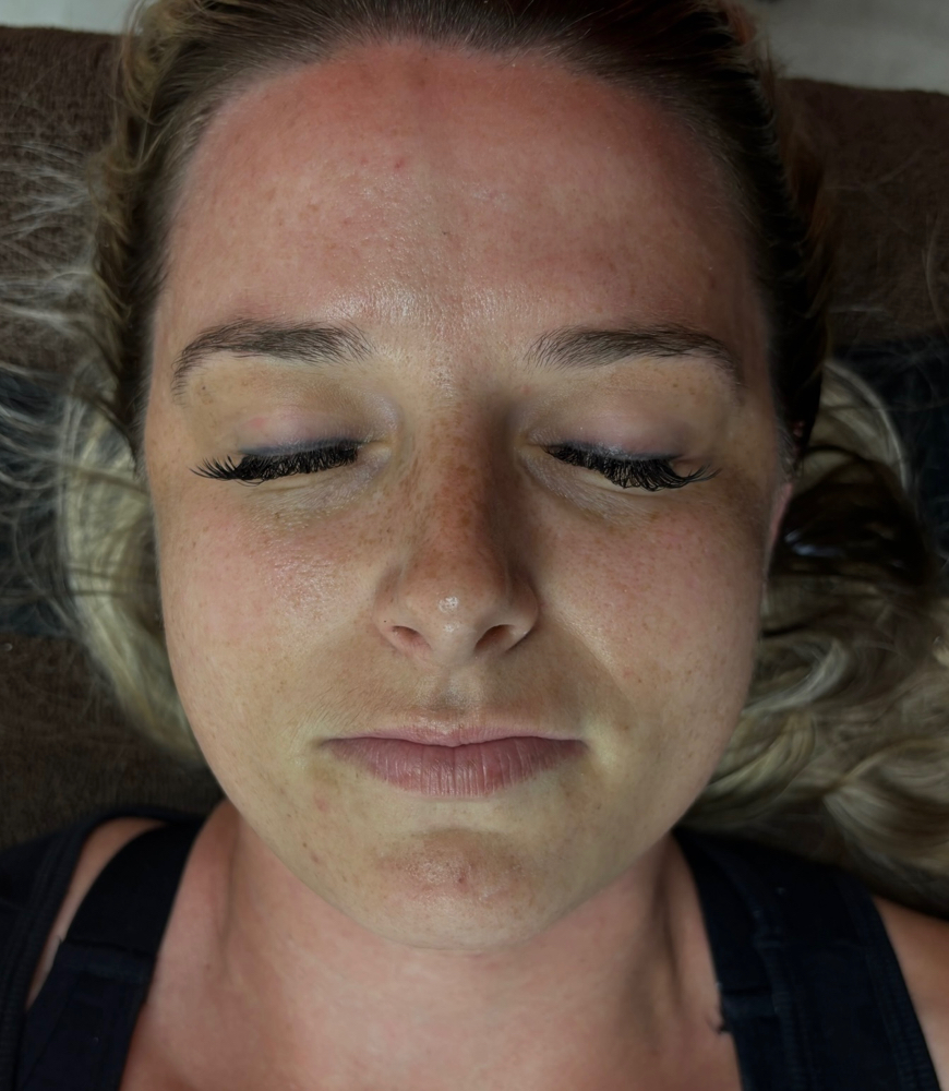The Total Reset Facial
