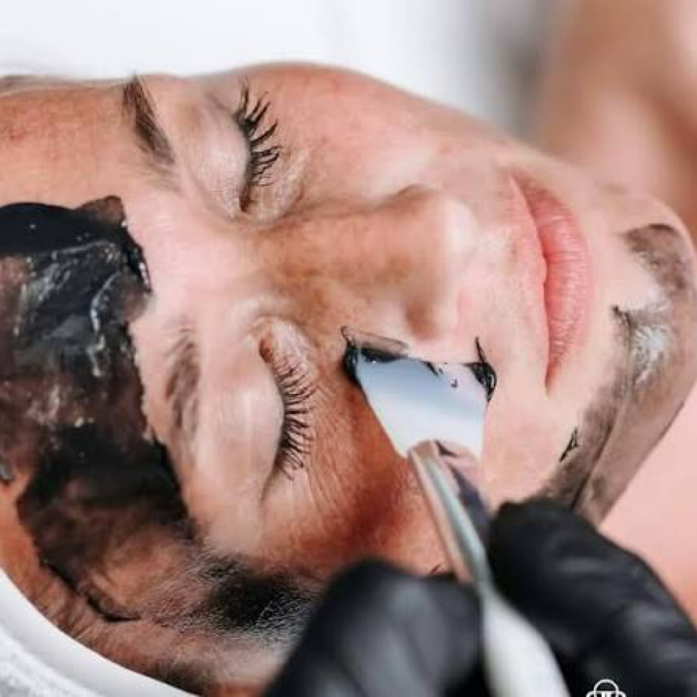 Deluxe C2O2 Acne Facial By Circad at ENDLESS BEAUTY AESTHETICS LLC in Grand praire, TX