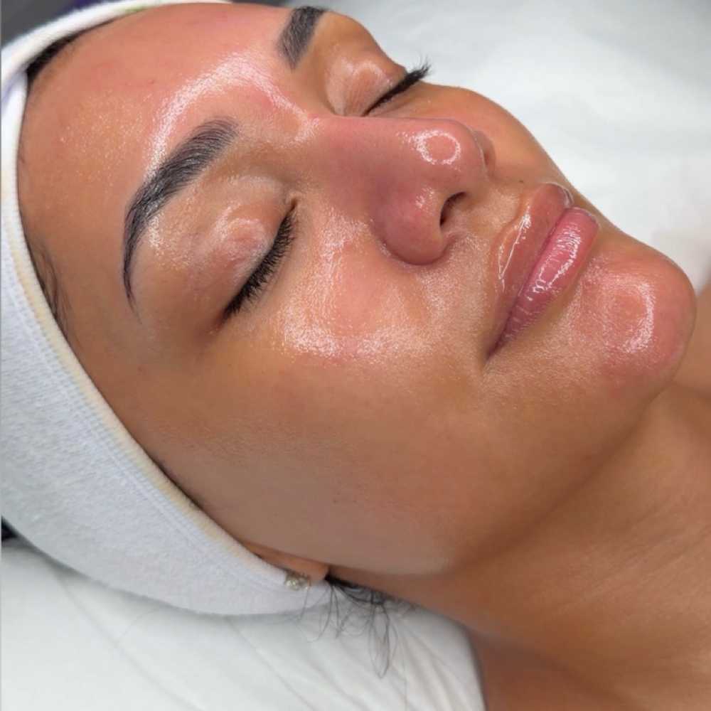 BioRepeel + PDRN Microneedling at Marta Rabelo Skin & Laser in Malden, MA