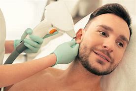 Ears-Laser Hair Removal