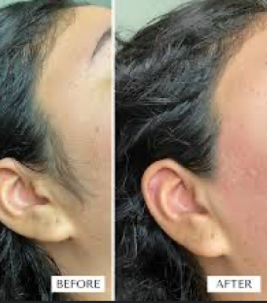Sides Of Face/ Sideburns