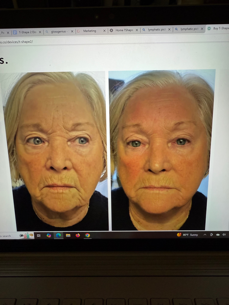 FACE & DECOLLETE (T2)