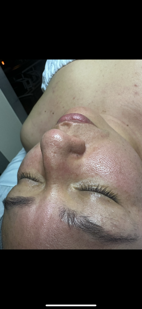 Deep Pore Facial