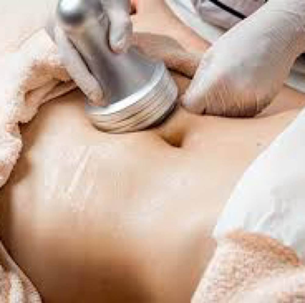RF Skin Tightening at Luminous Beauty Studio in Gillette, WY