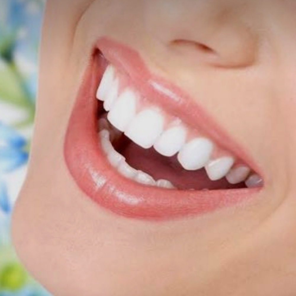 Advanced Teeth Whitening at Elysian Luxe in Bakersfield, CA