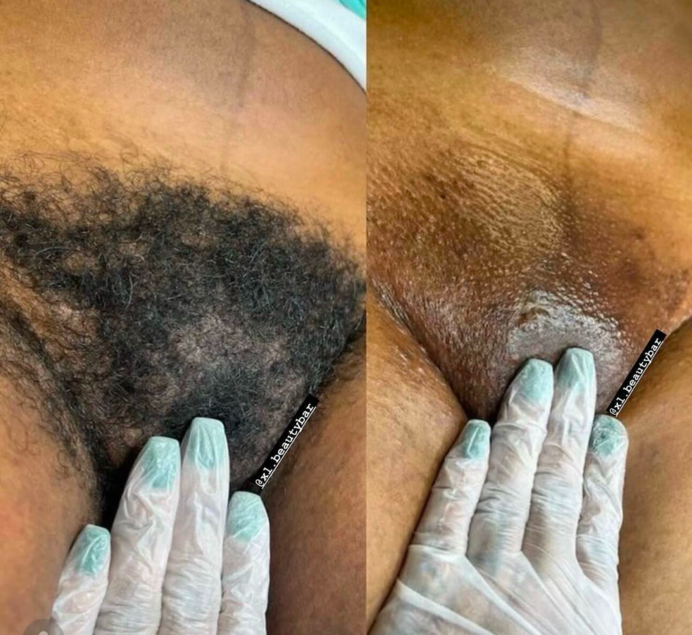 BRAZILIAN WAX