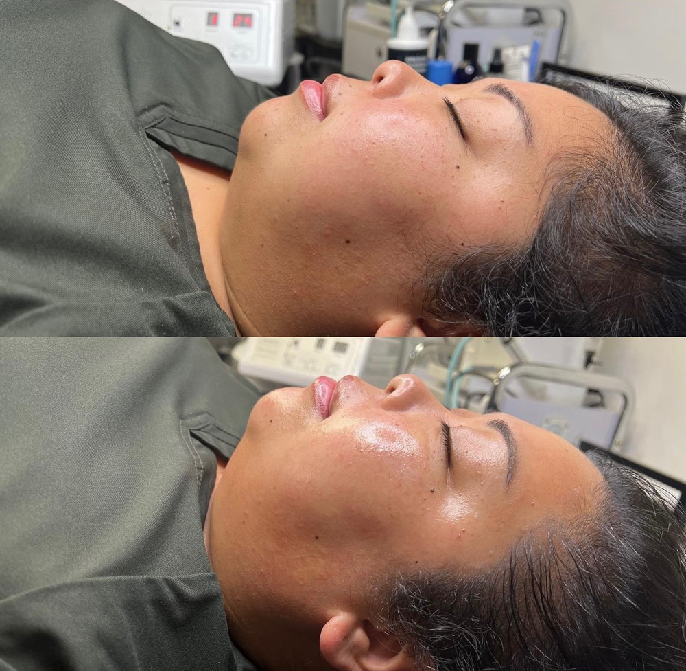 luxury signature facial