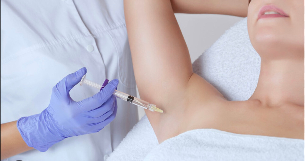 Hyperhidrosis Botox (underarm)