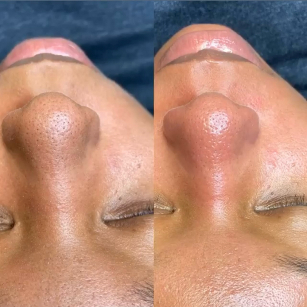 Custom Facial at The Lash Loft in Solon, OH