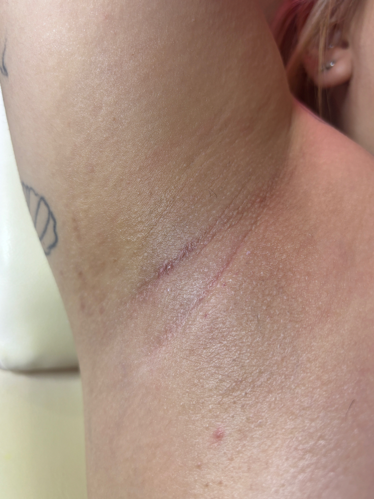 Precision Underarm Wax