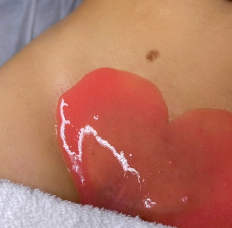 Vajacial at Beauty & Esthetics by Sol Luna in Inglewood, CA