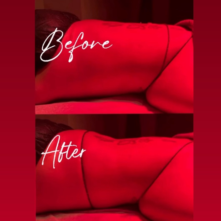 Brazillian Lymphatic Drainage Mass.