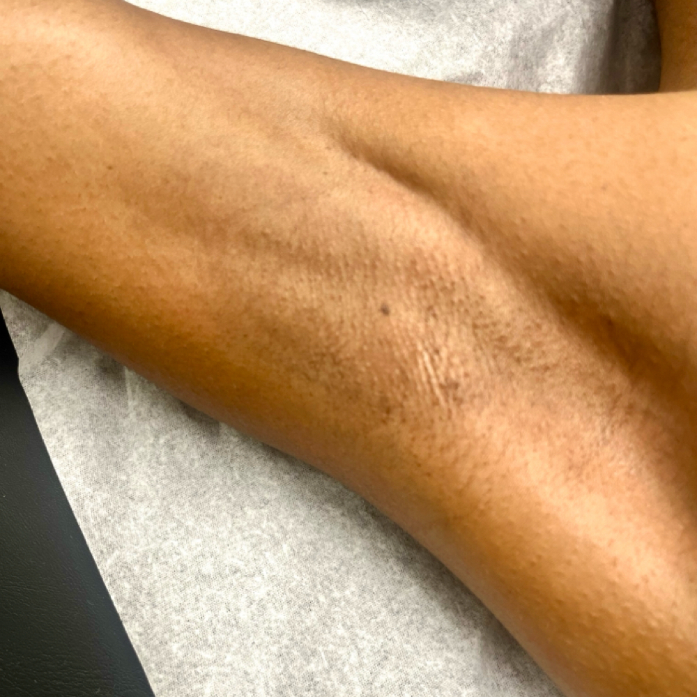 Underarm Wax at EttaJDerma Esthetics and Spa in Dallas, TX