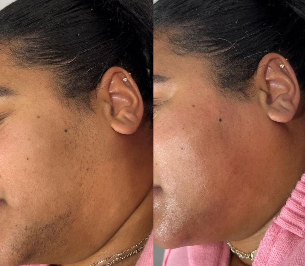 Chin Wax at Jontahontas’ Collection LLC. in Greenville, SC