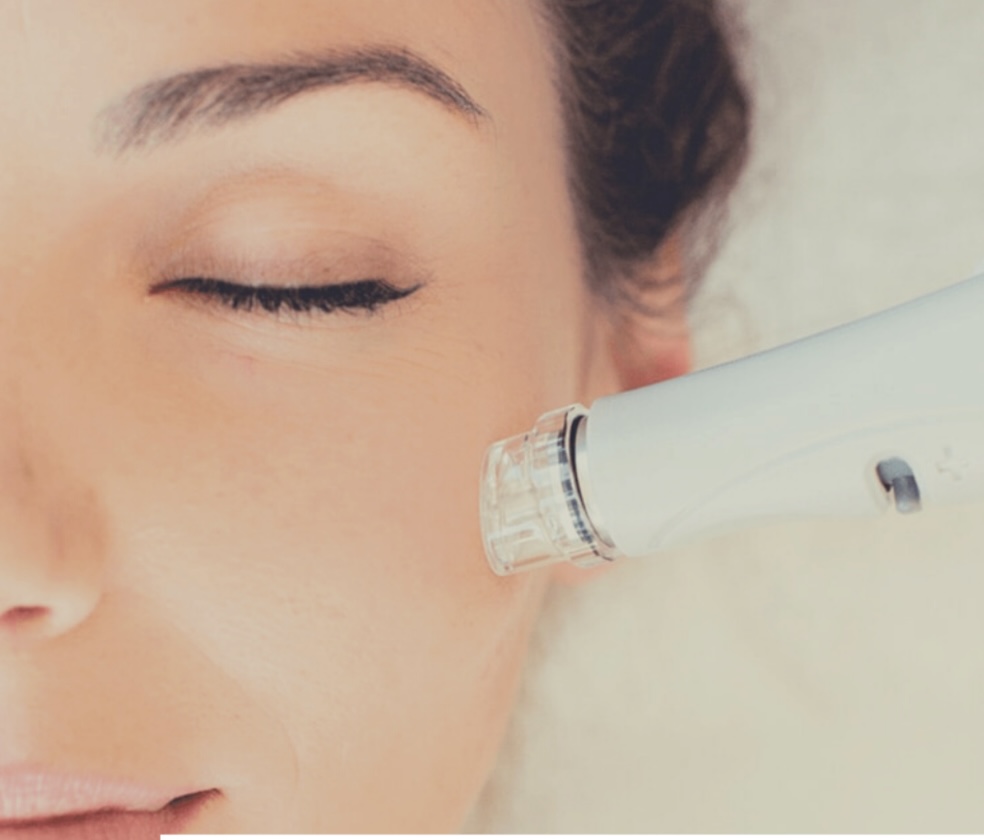Platinum Hydrafacial at SkinSoFine1 in TEXAS, TX