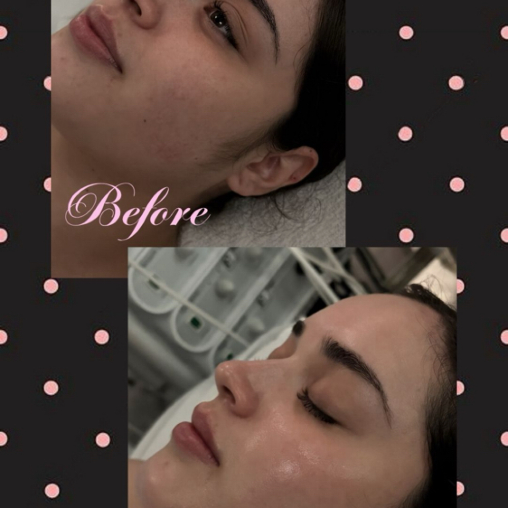 Model Facial at Vintage Kitty Esthetics in Los Angeles, CA