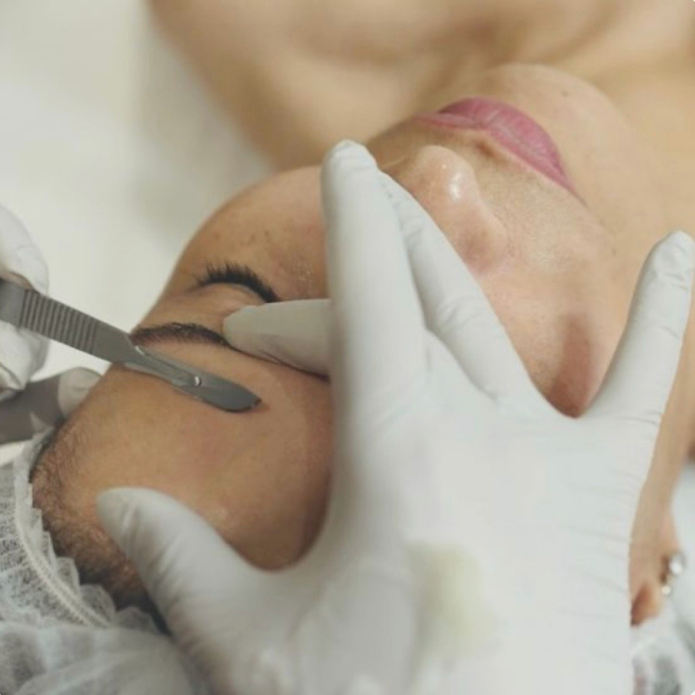 Mini Dermaplane at Dea Litsa Facial Spa in Chicago, IL