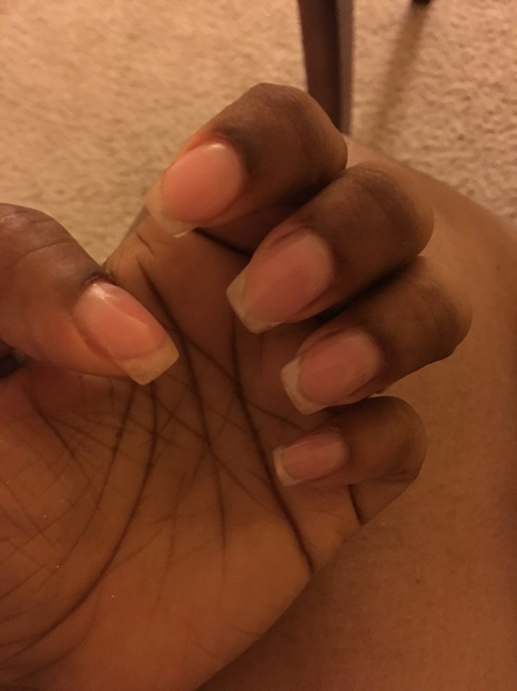 Short (Active Length) Set