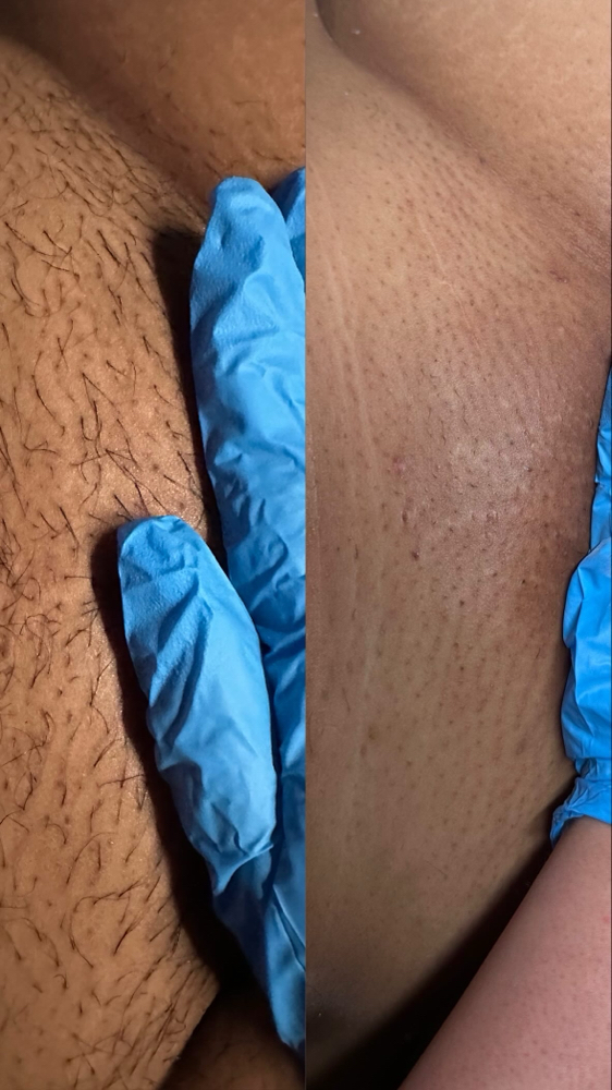 Brazilian Wax Special