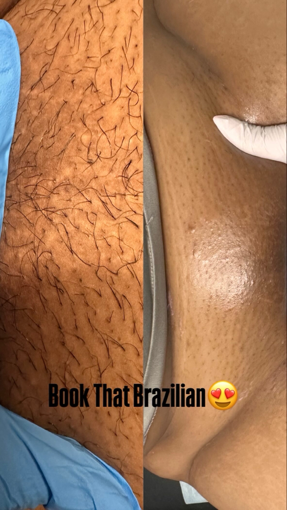 Brazilian Wax